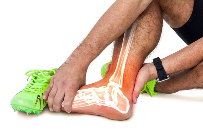 ruptura-tendon-achilian
